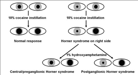 cocaine_amphetamine_horners.png cocaine_amphetamine_horners.png